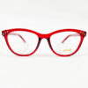 NVG OPH Frames Female Plastic OPHSC2520707